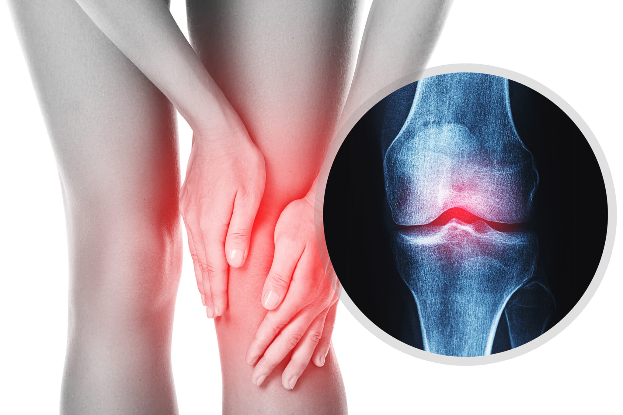 Is Your Joint Pain Osteoarthritis or Rheumatoid Arthritis?